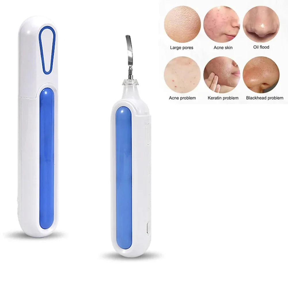 Wave Wholesale — Portable Ultrasonic Skin Scrubber — Sonic — in-use lifestyle view