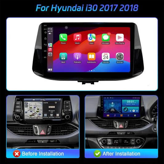 For Hyundai i30 2017 2018 CarPlay Car Radio Multimedia Player Navigation Wireless BT Carplay Android 14 Stereo 2K QLED Screen