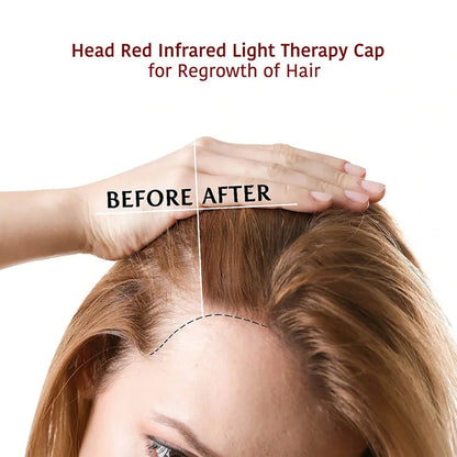 Red&Infrared Light Hair Growth Cap LED Red Light Therapy Cap For Hair Growth For Hair Loss Promote Hair Fast Regrow Care Hat