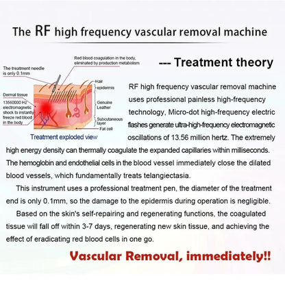 High Frequency Red Blood Vessel Vascular Removal 60W RF Facial Cleaner Beauty Machine Needle Spider Veins Remover Skincare Tool