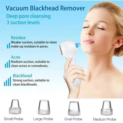 Wave Wholesale — Electric Blackhead Remover Vacuum — Remover — detail close-up