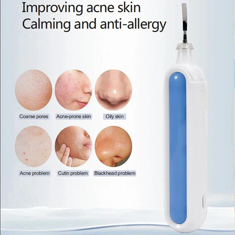 Wave Wholesale — Ultrasonic Facial Cleansing Device — Facial — alternate angle view